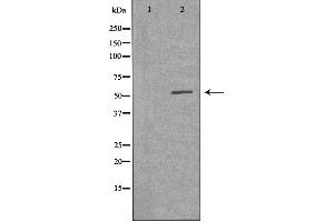 Image no. 2 for anti-Vaccinia Related Kinase 2 (VRK2) (Internal Region) antibody (ABIN6257548)