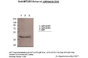 Image no. 2 for anti-Microtubule Associated Tumor Suppressor 1 (MTUS1) (N-Term) antibody (ABIN2781854)