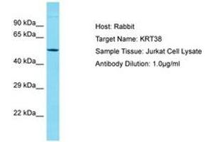 Image no. 1 for anti-Keratin 38 (KRT38) (AA 94-143) antibody (ABIN6750575)