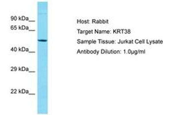 KRT38 Antikörper  (AA 94-143)