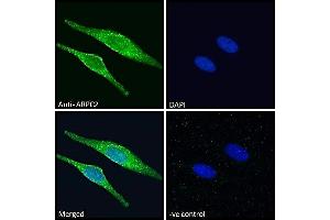 Image no. 4 for anti-Actin Related Protein 2/3 Complex, Subunit 2, 34kDa (ARPC2) (C-Term) antibody (ABIN184748)