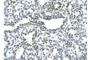 Image no. 4 for anti-Nuclear Factor of Activated T-Cells, Cytoplasmic, Calcineurin-Dependent 3 (NFATC3) (N-Term) antibody (ABIN2792685)