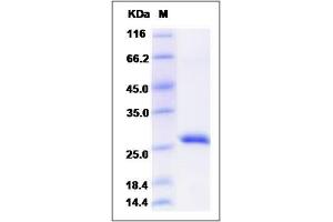 Image no. 1 for Ribulose-5-Phosphate-3-Epimerase (RPE) (AA 1-228) protein (His tag) (ABIN2008462)
