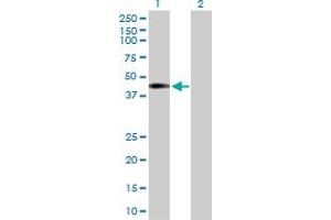 Image no. 2 for anti-Nucleoporin 43kDa (NUP43) (AA 1-380) antibody (ABIN531683)