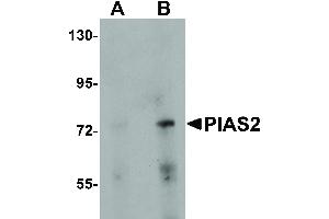 Image no. 1 for anti-Protein Inhibitor of Activated STAT, 2 (PIAS2) (N-Term) antibody (ABIN6656301)
