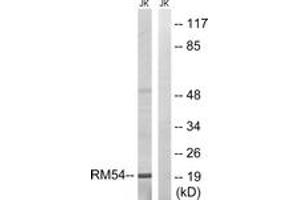 Image no. 1 for anti-Mitochondrial Ribosomal Protein L54 (MRPL54) (AA 81-130) antibody (ABIN1534514)