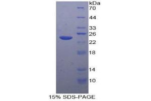 Image no. 1 for Tachykinin Receptor 2 (TACR2) protein (ABIN3011797)