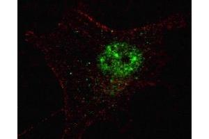 Fluorescent confocal image of SY5Y cells stained with PDX1 antibody.
