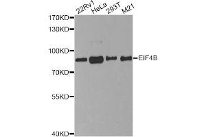 Image no. 4 for anti-Eukaryotic Translation Initiation Factor 4B (EIF4B) antibody (ABIN6569899)