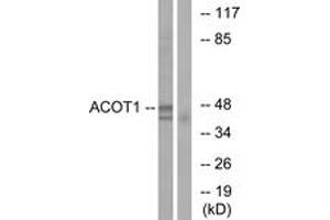 Image no. 1 for anti-Acyl-CoA Thioesterase 1 (ACOT1) (AA 91-140) antibody (ABIN1534597)