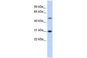 Image no. 2 for anti-Inhibitor of Growth Family, Member 3 (ING3) (N-Term) antibody (ABIN2777877)