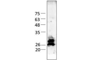 Western Blotting (WB) image for THO Complex 4 (THOC4) (AA 2-257) protein (His tag,Strep Tag) (ABIN3095871)