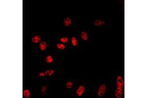 Immunofluorescent analysis of Cullin 2 staining in NIH3T3 cells.