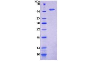 Image no. 1 for Periphilin 1 (PPHLN1) (AA 1-381) protein (His tag) (ABIN6238735)