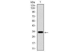 Image no. 3 for anti-Hyaluronan Synthase 3 (HAS3) (AA 312-364) antibody (ABIN1498588)