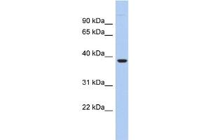 Image no. 1 for anti-Fat Storage-Inducing Transmembrane Protein 1 (FITM1) (N-Term) antibody (ABIN2785418)