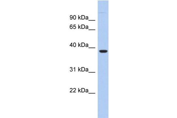 anti-Fat Storage-Inducing Transmembrane Protein 1 (FITM1) (N-Term) antibody