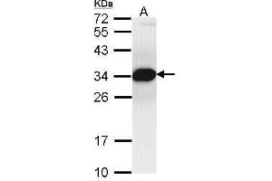 Image no. 2 for anti-Proteasome (Prosome, Macropain) Inhibitor Subunit 1 (PI31) (PSMF1) (C-Term) antibody (ABIN2855937)