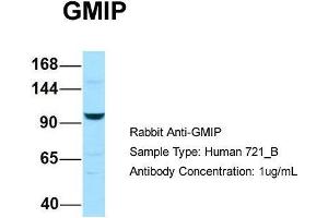Image no. 1 for anti-GEM Interacting Protein (GMIP) (C-Term) antibody (ABIN2790252)