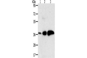 Image no. 1 for anti-Dihydrodiol Dehydrogenase (DDH) antibody (ABIN2426547)
