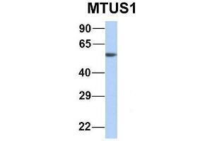 Image no. 10 for anti-Microtubule Associated Tumor Suppressor 1 (MTUS1) (Middle Region) antibody (ABIN2781855)