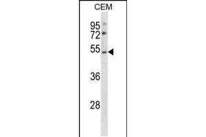 Image no. 1 for anti-Purinergic Receptor P2Y, G-Protein Coupled, 2 (P2RY2) (AA 324-352), (C-Term) antibody (ABIN5537259)