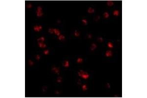 Image no. 2 for anti-Toll-Like Receptor 8 (TLR8) (Middle Region) antibody (ABIN500964)