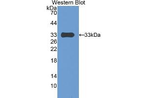 Image no. 2 for anti-Pregnancy-Associated Plasma Protein A, Pappalysin 1 (PAPPA) (AA 1270-1558) antibody (ABIN2921364)