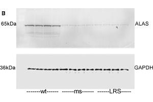 Image no. 3 for anti-Aminolevulinate, delta-, Synthase 2 (ALAS2) (Center) antibody (ABIN2854459)