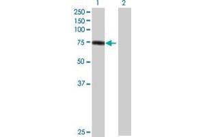 Image no. 1 for anti-Plakophilin 1 (PKP1) (AA 1-726) antibody (ABIN518939)