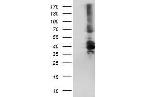 anti-Dystrobrevin, beta (DTNB) antibody