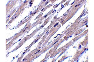 Image no. 2 for anti-BCL2-Like 13 (Apoptosis Facilitator) (BCL2L13) (Middle Region) antibody (ABIN1030885)