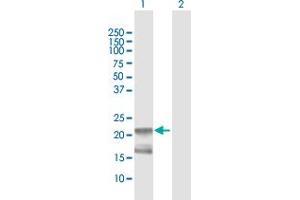 Image no. 1 for anti-Relaxin 1 (RLN1) (AA 1-185) antibody (ABIN519787)