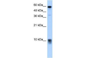 Image no. 2 for anti-S100 Calcium Binding Protein A3 (S100A3) (N-Term) antibody (ABIN2777134)