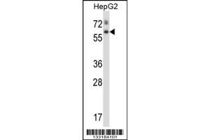 Western Blotting (WB) image for anti-Asparaginase Homolog (ASPG) (Center) antibody (ABIN2159304)
