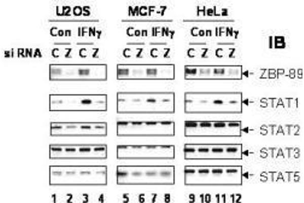 anti-Zinc Finger Protein 148 (ZNF148) antibody