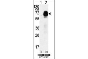 Image no. 1 for anti-Anti-Mullerian Hormone Receptor, Type II (AMHR2) (AA 65-91), (N-Term) antibody (ABIN391174)
