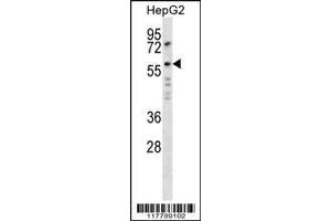 Image no. 3 for anti-Angiopoietin 2 (ANGPT2) (AA 404-432), (C-Term) antibody (ABIN654062)