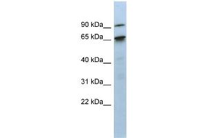 anti-CBP80/20-Dependent Translation Initiation Factor (CTIF) (N-Term) antibody