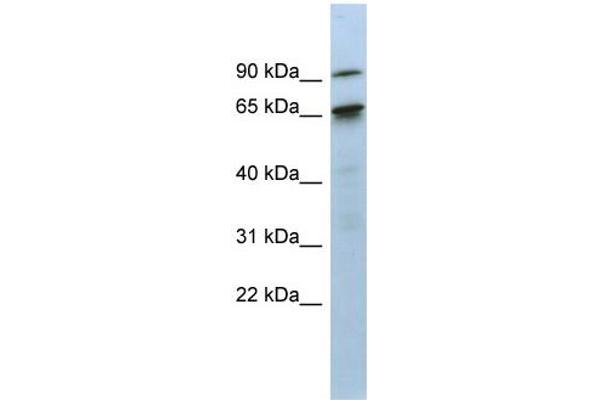anti-CBP80/20-Dependent Translation Initiation Factor (CTIF) (N-Term) antibody