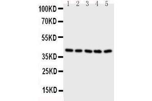 Image no. 2 for anti-Branched Chain Amino-Acid Transaminase 2, Mitochondrial (BCAT2) (AA 377-392), (C-Term) antibody (ABIN3043181)