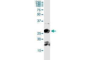 Western Blotting (WB) image for BCAP29 (Human) IP-WB Antibody Pair (ABIN1989478)