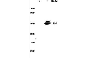 anti-Beclin 1, Autophagy Related (BECN1) (AA 201-330) antibody