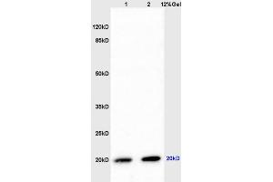 Image no. 3 for anti-Parkinson Protein 7 (PARK7) (AA 101-189) antibody (ABIN674739)