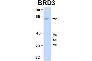 Image no. 2 for anti-Bromodomain Containing 3 (BRD3) (Middle Region) antibody (ABIN2775791)