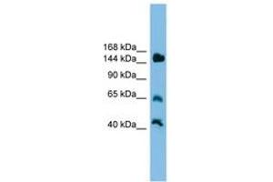 Image no. 1 for anti-Jumonji, AT Rich Interactive Domain 2 (JARID2) (AA 201-250) antibody (ABIN6744599)