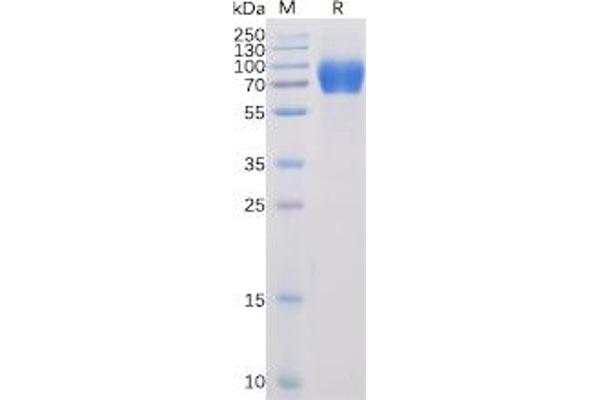 Signaling Lymphocytic Activation Molecule Family Member 1 (SLAMF1) protein (mFc-His Tag)