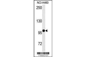 Image no. 1 for anti-Homeodomain Interacting Protein Kinase 2 (HIPK2) (AA 344-372) antibody (ABIN391778)