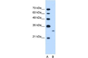 anti-MAP3K7 C-Terminal Like (MAP3K7CL) (C-Term) antibody