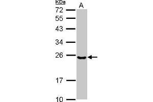 Image no. 2 for anti-Ubiquitin-Conjugating Enzyme E2T (Ube2t) (C-Term) antibody (ABIN2856389)